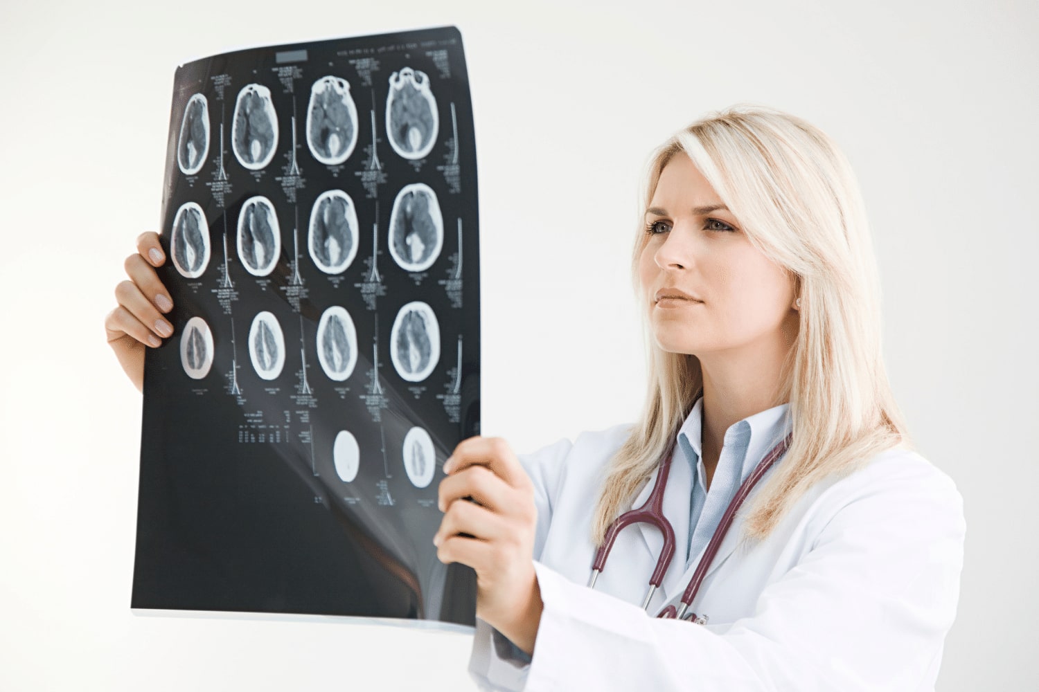 MRI for the diagnosis of Multiple Sclerosis in Brooklyn,NY